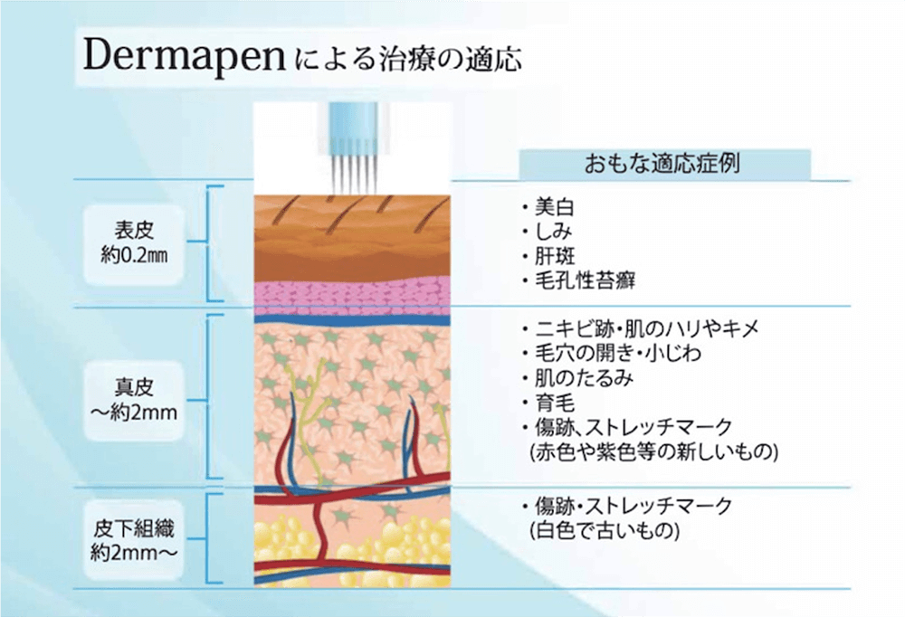 Dermapenによる治療の適応