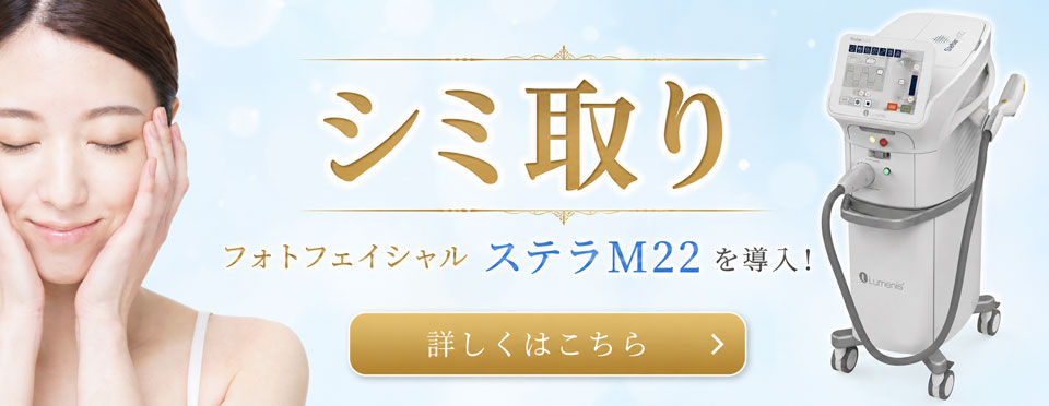 シミ取り治療の紹介バナー。フォトフェイシャル ステラM22導入。
